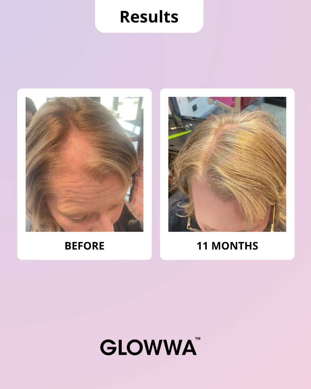 Glowwa Hair Food Menopause - 60 capsule vegetali