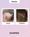Donna over 45 con capelli folti grazie a Glowwa Hair Food Menopause
