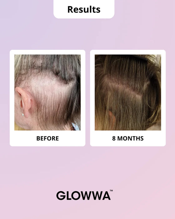Donna over 45 con capelli folti grazie a Glowwa Hair Food Menopause