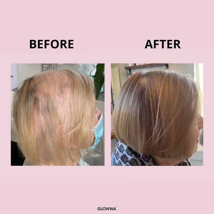 Donna con capelli forti e luminosi grazie a Glowwa Hair Food Original