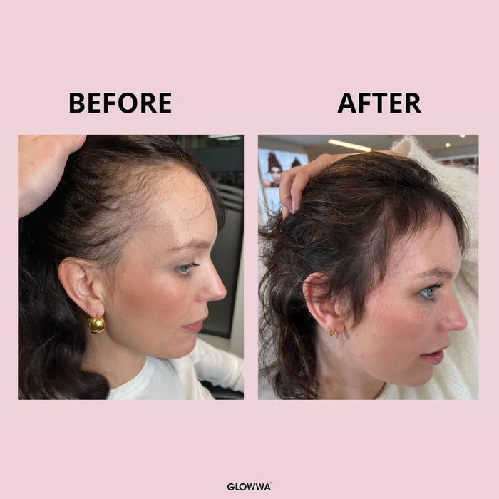 Risultati prima e dopo 90 giorni con Glowwa Hair Food Original