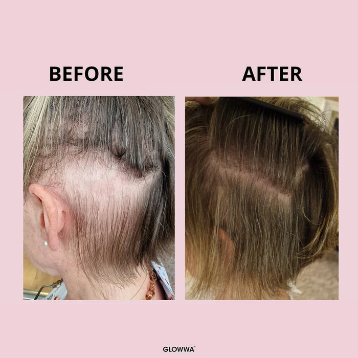 Risultati trial clinico Glowwa Hair Food Original: 96%, 98%, 100%